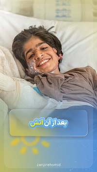 بعد از آن آتش… بعد از آن آتش…